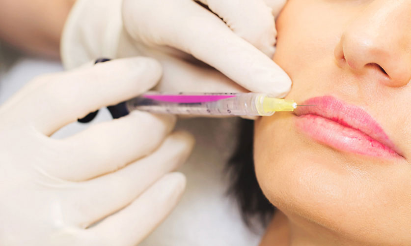 Dermal Fillers | Restore Volume & Smooth Wrinkles